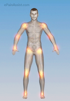 joint pain highlighted for spots of arthritis.