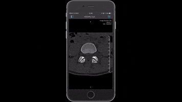 craig_purview dicom imaging mobile medical imaging 3d medical images GIF