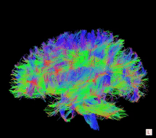 Human Brain GIF by The University of Melbourne