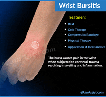 Causes Of Wrist Bursitis GIF by ePainAssist.com