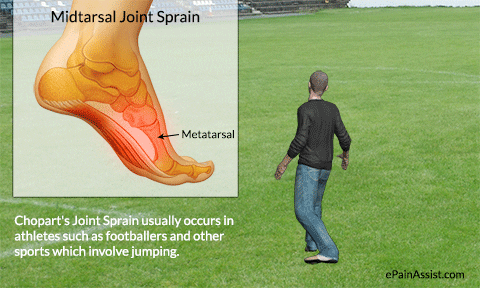 tarsal ligament meaning, definitions, synonyms