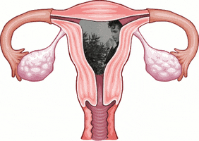 Prince Uterus GIF by Abortion Access Front