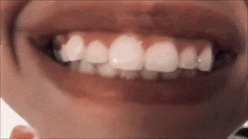 teeth GIF by Alessia Cara