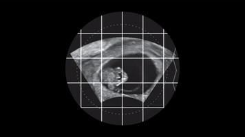 Wishing Girl GIF by lolamarsh