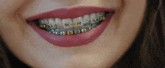 braces GIF by Marshmello