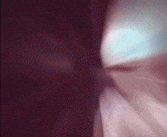 Blitz The League Concussion GIF