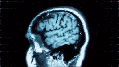 Brain Anatomy Gif By Harvard University Find Share On Giphy