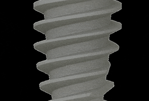 singularimplants GIF