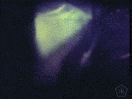 200.gif?cid=fc005b08a6aaac1b2420582f98da2e9d4ff8b19c04fc6c04&rid=200.gif&ct=g