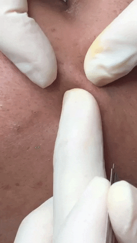 Ring Spa GIF