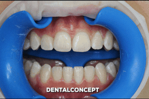 davidantoniovilcaobregon dentalconcept GIF