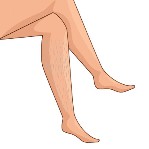 Laserhairremoval Sticker by TiamSpa