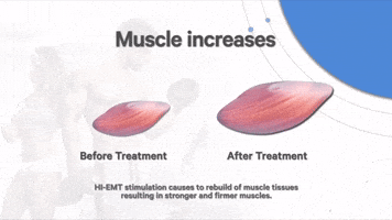 Cmslim GIF