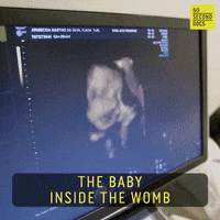 Expecting New Born GIF by 60 Second Docs