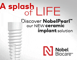 NobelBiocareNA implant dental implant dentalimplant nobelbiocare GIF
