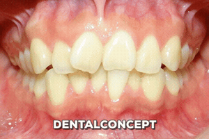 davidantoniovilcaobregon dentalconcept GIF