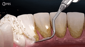 Teeth Dentist GIF by PBS Digital Studios