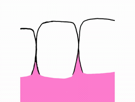 Dente GIF