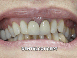 davidantoniovilcaobregon dentalconcept GIF