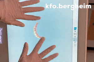 kfobergheim digital dentistry scan invisalign GIF