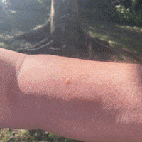 Shark Tank Mosquito GIF by Bug Bite Thing