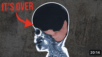 Shrinking Its Over GIF