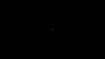 Implantology GIF by TRI Dental Implants