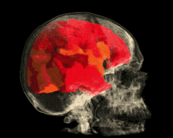 skull brain GIF