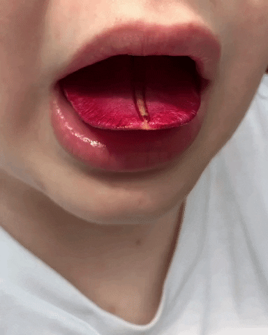 Animated GIF