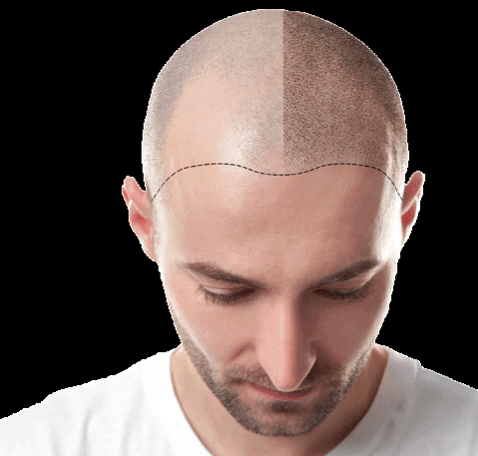 Permanent-tattoos GIFs - Get the best GIF on GIPHY