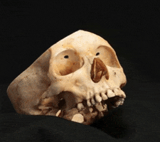 skull lebotomy GIF by Mütter Museum