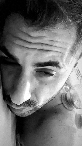 Massage Cupping GIF by alessandrosherpa