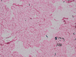 scanning gram positive GIF by Ansel Oommen