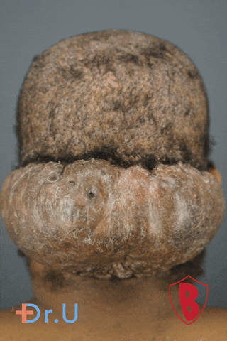 Transformation Dru GIF by Dr. U Hair and Skin Clinic