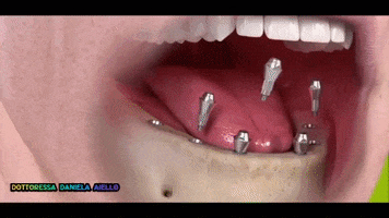 Teeth Salerno GIF by DOTTORESSA DANIELA AIELLO