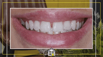 Happy Teeth GIF by The Dental House