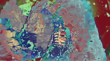 200.gif?cid=fc005b08e464925fe898f49dc04510354c461b48e4b469e7&rid=200.gif&ct=g