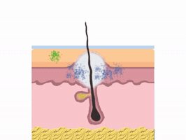 How Ophelia Probiotics Work GIF