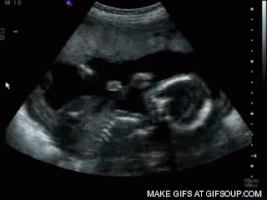 fetus sonogram GIF
