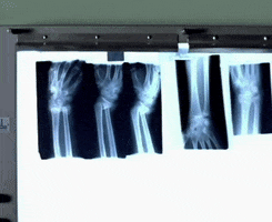 Hey Boy Hey Girl Xray GIF by The Chemical Brothers