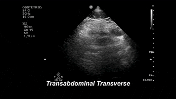 drjeffy foamed foamus GIF