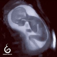 Pro-Life Foetus GIF by sundaysforlife