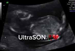 Son Ultrason GIF