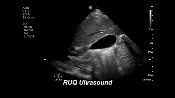 drjeffy foamed foamus GIF