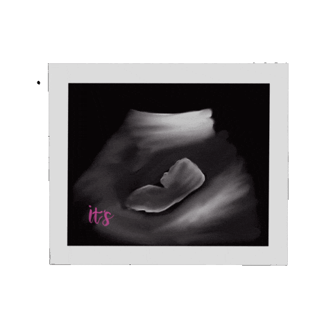 Ultrasound Radiology Sticker