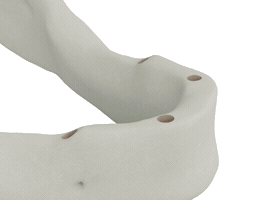 Dental Implants Sticker by BioHorizons