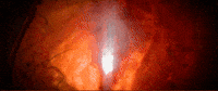 Meat Tunnel GIF
