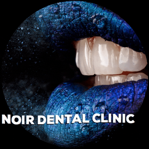 NoirDentalClinic smile dentistry dentysta noir dental clinic GIF