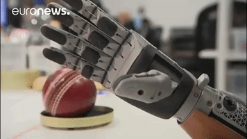 prosthetic hand GIF by euronews