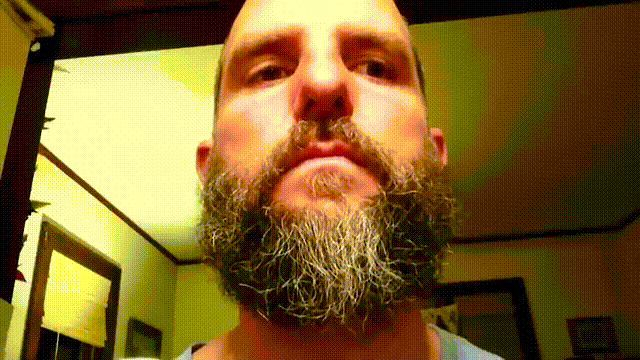beard problems GIF
